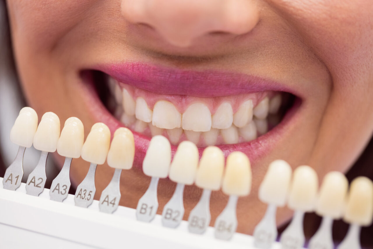 Dentist examining female patient with teeth shades at dental clinic